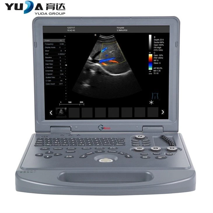 4 Dimensional Portable Doppler Ultrasound